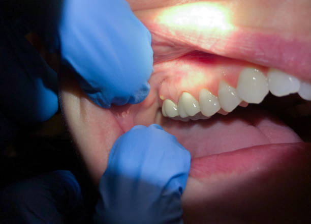 Best Knocked-Out Tooth Emergency  in Lehi, UT